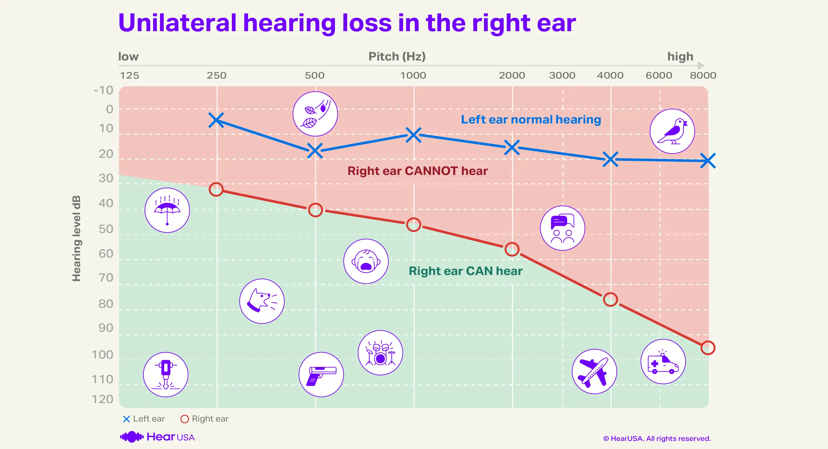 Unilateral audiogram